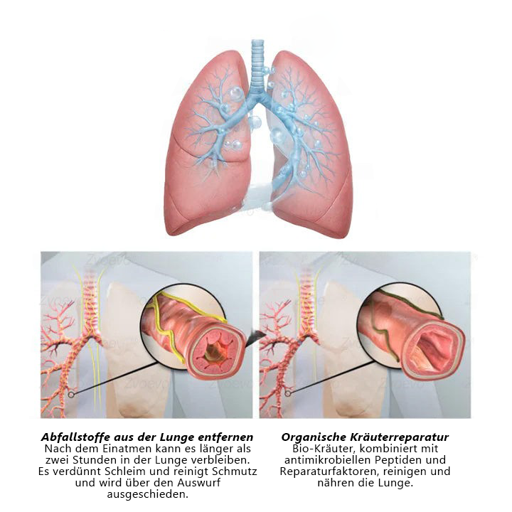 Offizieller Shop🌐𝑴𝒖𝒓𝒘𝒐𝒏® 𝐁𝐨𝐭𝐚𝐧𝐢𝐬𝐜𝐡𝐞𝐫 𝐌𝐮𝐥𝐥𝐞𝐢𝐧 𝐋𝐮𝐧𝐠𝐞𝐧𝐫𝐞𝐢𝐧𝐢𝐠𝐮𝐧𝐠𝐬𝐝𝐢𝐟𝐟𝐮𝐬𝐨𝐫🌿𝐡𝐨𝐜𝐡𝐤𝐨𝐧𝐳𝐞𝐧𝐭𝐫𝐢𝐞𝐫𝐭𝐞 𝐅𝐨𝐫𝐦𝐞𝐥 𝐳𝐮𝐫 𝐋𝐢𝐧𝐝𝐞𝐫𝐮𝐧𝐠 𝐯𝐨𝐧 𝐇𝐮𝐬𝐭𝐞𝐧, 𝐒𝐜𝐡𝐥𝐞𝐢𝐦, 𝐀𝐬𝐭𝐡𝐦𝐚 𝐮𝐧𝐝 𝐂𝐎𝐏𝐃(🔥 LETZTER TAG 70% RABATT🔥)