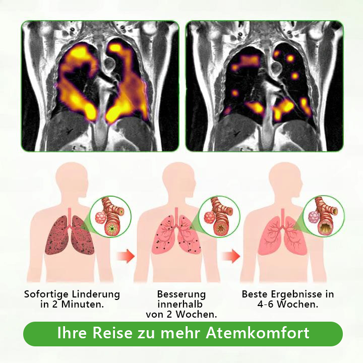 Offizieller Shop🌐𝑴𝒖𝒓𝒘𝒐𝒏® 𝐁𝐨𝐭𝐚𝐧𝐢𝐬𝐜𝐡𝐞𝐫 𝐌𝐮𝐥𝐥𝐞𝐢𝐧 𝐋𝐮𝐧𝐠𝐞𝐧𝐫𝐞𝐢𝐧𝐢𝐠𝐮𝐧𝐠𝐬𝐝𝐢𝐟𝐟𝐮𝐬𝐨𝐫🌿𝐡𝐨𝐜𝐡𝐤𝐨𝐧𝐳𝐞𝐧𝐭𝐫𝐢𝐞𝐫𝐭𝐞 𝐅𝐨𝐫𝐦𝐞𝐥 𝐳𝐮𝐫 𝐋𝐢𝐧𝐝𝐞𝐫𝐮𝐧𝐠 𝐯𝐨𝐧 𝐇𝐮𝐬𝐭𝐞𝐧, 𝐒𝐜𝐡𝐥𝐞𝐢𝐦, 𝐀𝐬𝐭𝐡𝐦𝐚 𝐮𝐧𝐝 𝐂𝐎𝐏𝐃(🔥 LETZTER TAG 70% RABATT🔥)